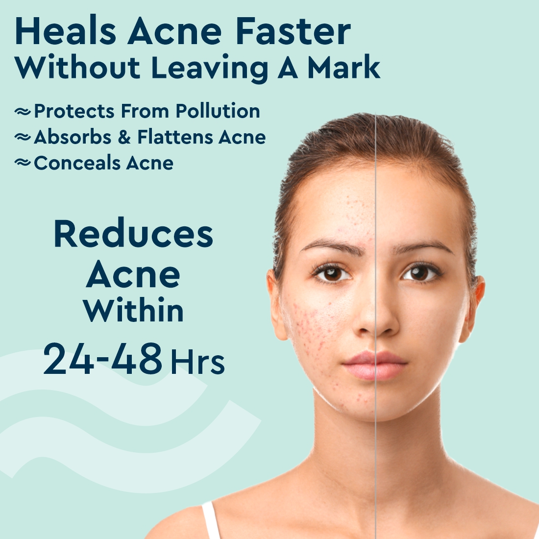 Acne Patches (100% Hydrocolloid) 36 PCs